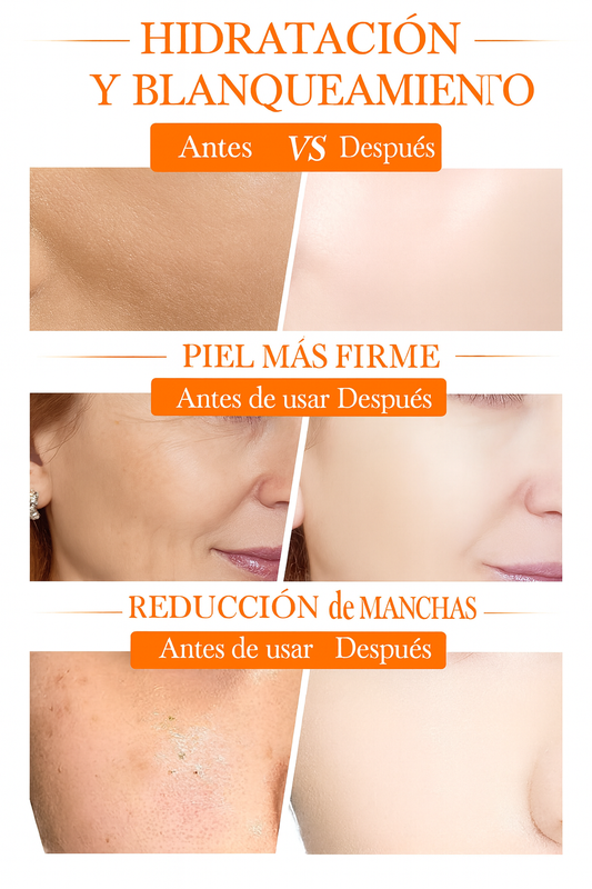 VitaLumi ®  Crema Facial Blanqueadora Iluminadora 5 en 1 con Vitamina C Activa + Niacinamida – Piel Radiante en Cada Aplicación